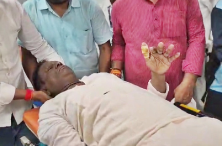 मुख्यमंत्री नीतीश कुमार के कार्यक्रम में भागलपुर सांसद लड़खड़ाकर गिरे, पैर में लगी चोट