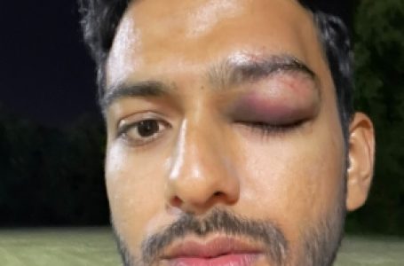 Former India U-19 star Unmukt Chand suffers serious eye injury; says grateful to have survived a possible disaster