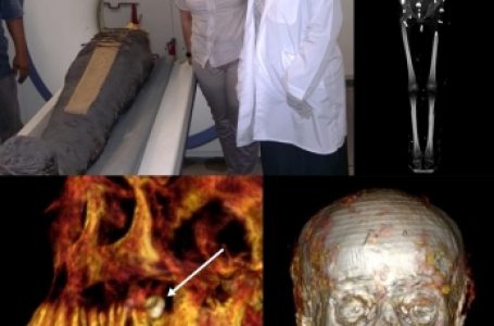 Egyptian researchers find amulets inside 2,300-year-old mummy via ‘digital unwrapping’