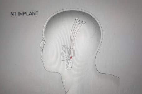 Musk’s Neuralink now recruiting for 1st human trial of its brain-computer interface
