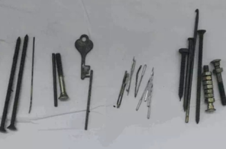 Nails, needles, nuts and bolts removed from man’s stomach in Jaipur