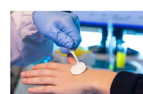 New Vitamin C-rich bandage to boost burn healing