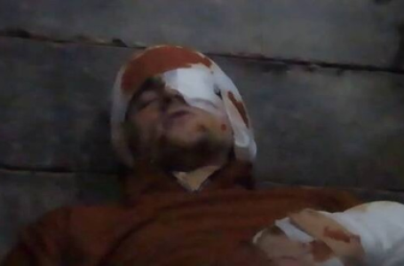 Hamas releases video of hostage allegedly injured in Israeli attack on Gaza