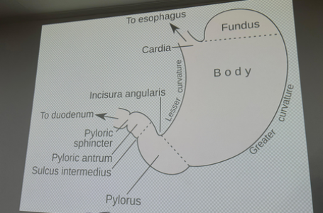 Metabolic surgery can help prevent organ damage, failure due to uncontrolled diabetes: AIIMS doctor